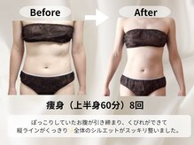 モア 星ヶ丘店(MORE)/お客様痩身ビフォーアフター