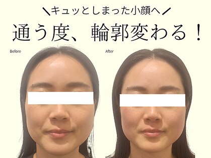 REGISTA ボディ&フェイシャルケアサロン/筋膜リリース/小顔矯正の写真
