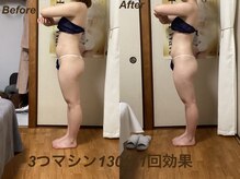 ミュー 新小岩店(Mieux)/３つマシン1回効果