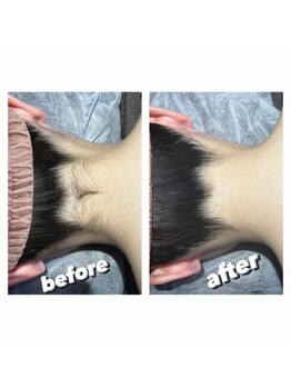 ファウンデーション(FOUNDATION)/襟足のお手入れ施術例♪