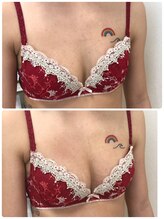 アンドモア(&more)/バストアップ症例