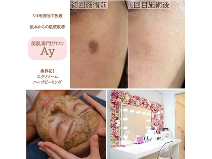エーワイ(Ay)の写真