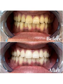 ライトビューティー 池袋店(LightBeauty)/症例写真