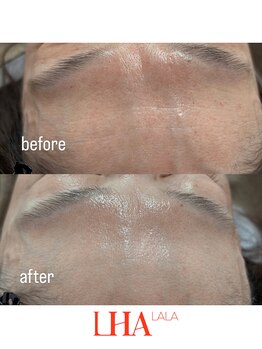 トゥインクル(Twinkle)/くすみ・毛穴・ハリ・ツヤ