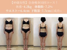 エターナルフレーム(Eternal Flame)/49歳痩身スリムビフォーアフター