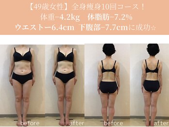 エターナルフレーム(Eternal Flame)/49歳痩身スリムビフォーアフター