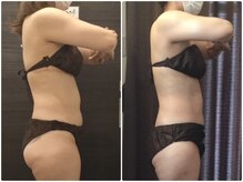 美容整体ウェリナ 中川八田院/小顔矯正/骨盤矯正/痩身整体