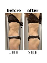 インディバケアプラチナム 横浜店/インディバ施術