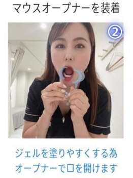 ホワイトニングショップ 三島店(WHITENING SHOP)/【ホワイトニングの流れ】２