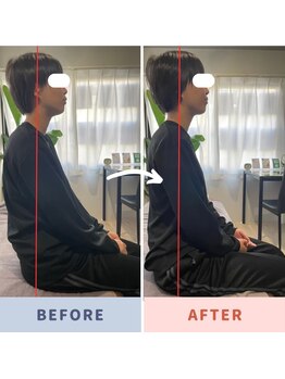 マクシル 札幌店 puls1(MAXIL)/学生時代から腰痛