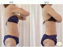 トレゾール(tresor)/★痩身★赤坂痩身エステ