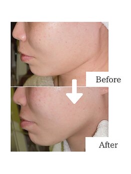 グラシア(gracia)/シミ・毛穴ケア専門店gracia