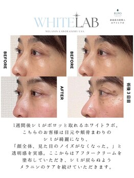 ルポザメンテナンス 長岡店(RUPO THE MAINTENANCE)/シミケア　ホワイトラボ