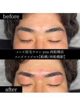 ユー 西船橋店(you)/ビフォーアフター写真