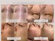 ベストベル(BestBelle)の写真