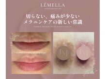 リリーイー(LILY E)の雰囲気（唇、乳輪、膝、肘、VIO、お尻の下などの黒ずみ改善）