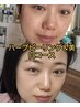 人気★ハーブピーリング&美白保湿ケア】毛穴洗浄込み・ツヤ水光肌へ