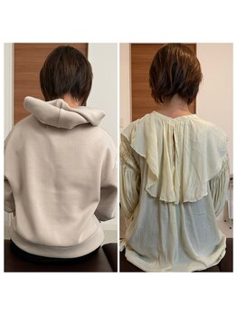 ハルノハナ鍼灸治療院/後ろ姿の歪みも改善できます