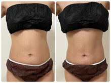 巡りサロン結希(ゆき)/ボディマッサージ