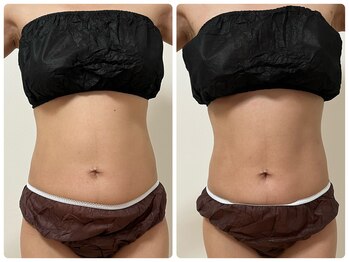 巡りサロン結希(ゆき)/ボディマッサージ