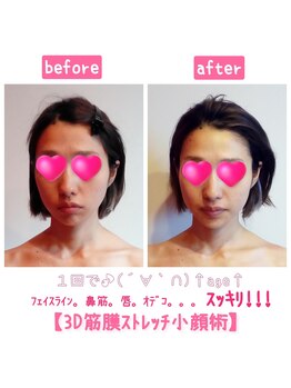 ビューティサロン キヨの部屋(beauty salon)/【３D筋膜ストレッチ小顔術】1回