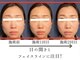 ディオスマイル(diosmile)の写真