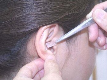 ここセラ/針は使わずテープで目立ちにくい