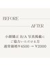 【 お顔出し・before / after 写真掲載OKの方！】小顔矯正 ￥4500→￥2000