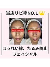 シン(Shin)/【ほうれい線ケア】