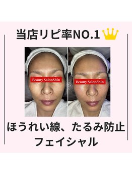 シン(Shin)/【ほうれい線ケア】