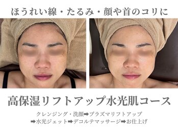 エクラ イオンモール徳島店(ECLAT)/高保湿リフトアップ水光肌コース