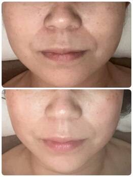 ココナチュレ(coconature)/美白炭酸パックで血行促進♪