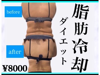 アールズ スリム(R's slim)/脂肪冷却痩身！大人気の部分集中