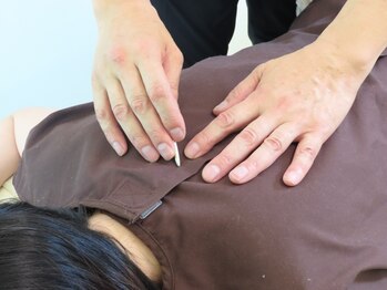 かつらはりきゅう 小児しんの写真/《整体×鍼》で整体以上の効果を実感！急性の痛みも、なかなか改善しなかった慢性的な不調の根本改善へ◎