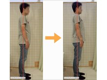 リファイン(Refine)/たった一度でもこの姿勢の変化！