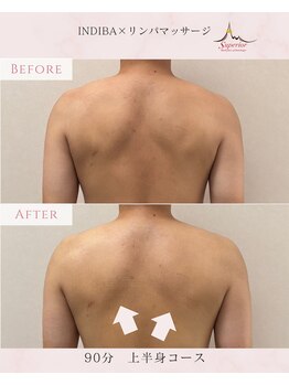 スーペリオル(Superior)/肩回りのガチガチのコリ解消