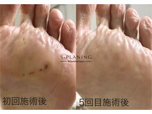 ロンディネ(Rondine)の雰囲気（足裏の改善を目的とした方にお勧めです。）