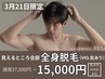 3月21日来店限定【メンズ脱毛】まるっと全身脱毛(VIO髭あり)初回15,000円