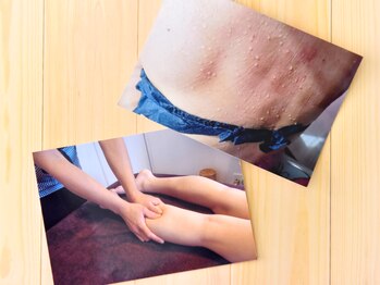 ローブメール(Robemail)/施術写真