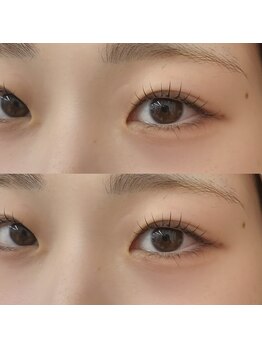 ケーオーエス ピンク(K O S Pink)/カールデザイン