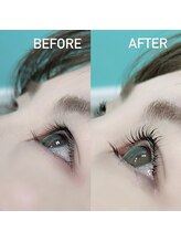 ステラ(STELLA)/防腐剤フリー！最新のまつぱ