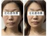 モニター頭蓋骨小顔矯正◎Before After写真や動画撮影OKの方¥3,980
