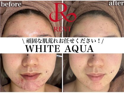 ホワイトアクア 岐阜店(WHITE AQUA)の写真