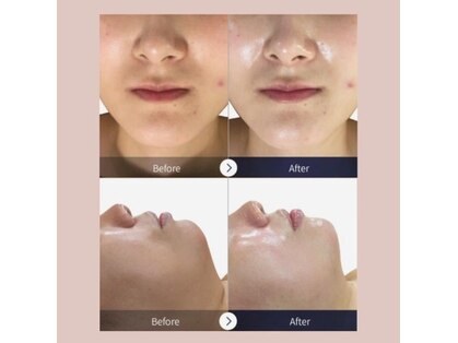 チョンダムビューティー(chondam beauty)の写真