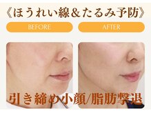 ムーンライズ(moonrise)/