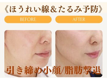 ムーンライズ(moonrise)/