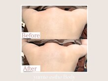 トータルビューティー ゆみえエステ(Total Beauty)/