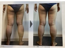 メディカルサロン フィオレ(fiore)/ボディ引き締め