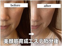 リエル(RIEL)/小顔矯正×美顔筋育成エステ