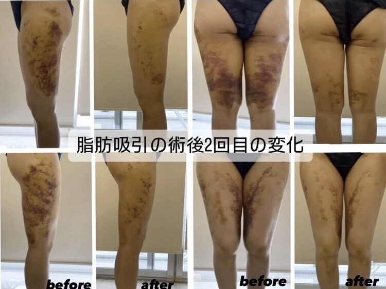 インディバサロン ミイ(MII)｜ホットペッパービューティー